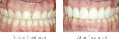 Dentist Mesa - Gallery Image 01