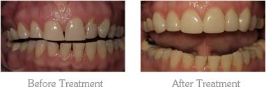 Dentist Mesa - Gallery Image 01