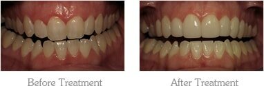 Dentist Mesa - Gallery Image 01