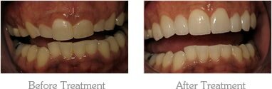 Dentist Mesa - Gallery Image 01