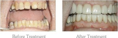 Dentist Mesa - Gallery Image 01